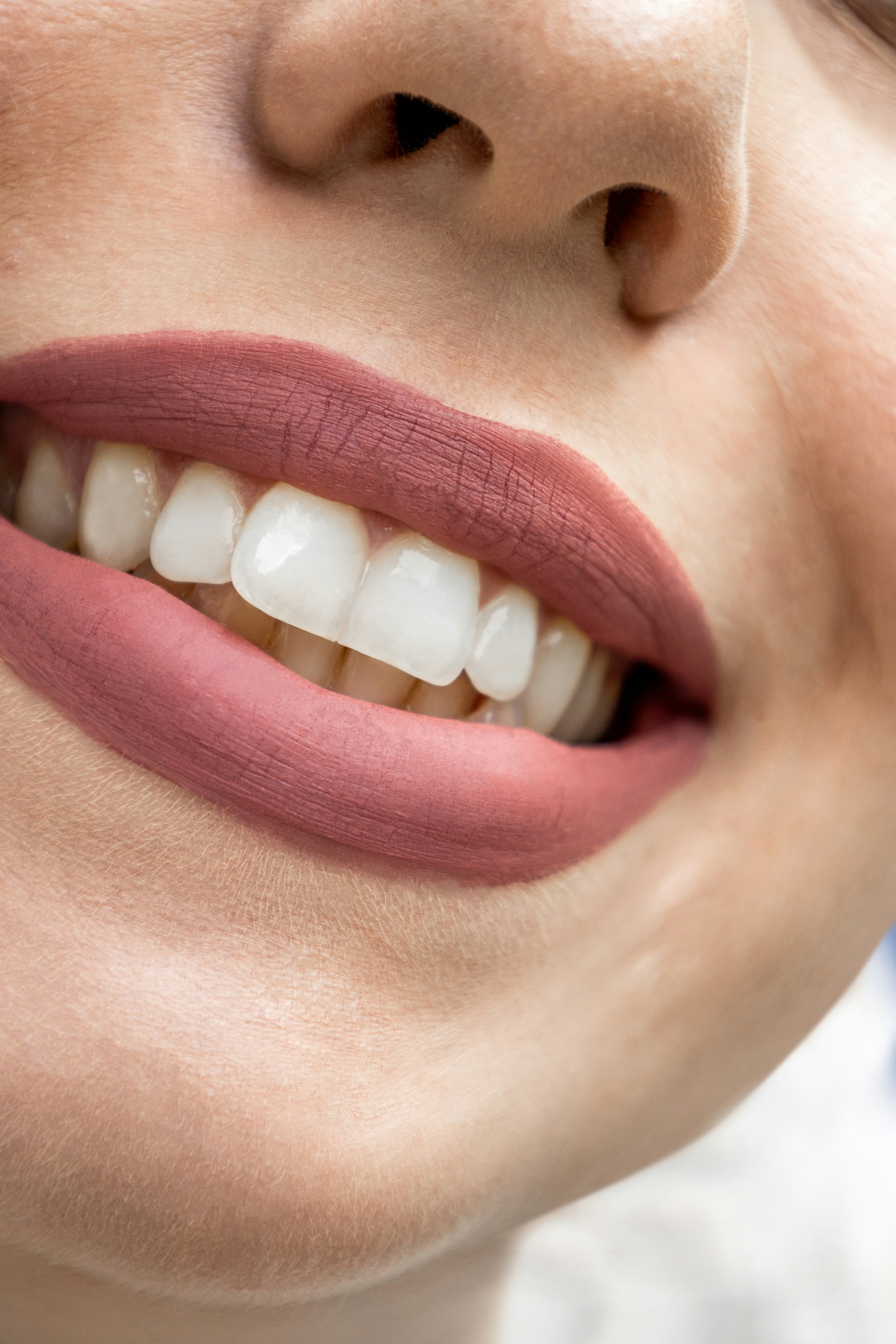 Dental Bridges Los Angeles &mdash; Rayhan & Marvizi, DDS