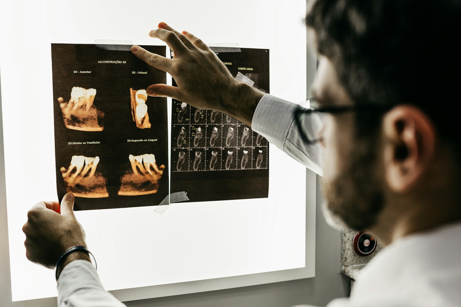 Dental Implants Los Angeles — Rayhan & Marvizi, DDS